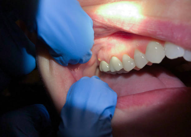  Ponderosa Pine, NM Emergency Dentist Pros